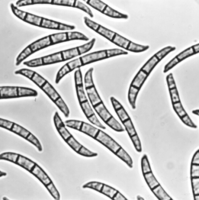 눈마름병 병원균 분생포자
