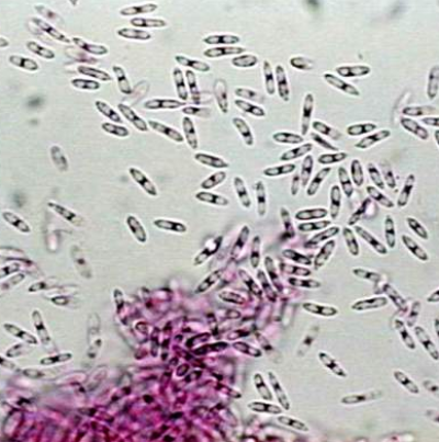 병원균(자낭포자)