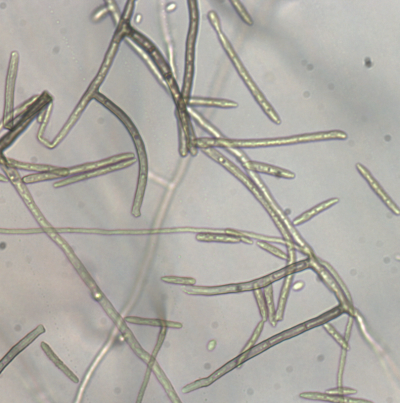 병원균(Stenella sp. 분생자경 및 분생포자)