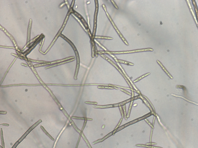 병원균(Stenella sp. 분생자경 및 분생포자)