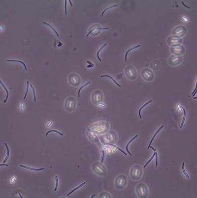병원균(α와 β 병포자)