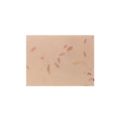 병원균(분생포자)