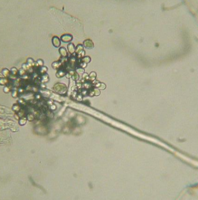 병원균(분생포자)