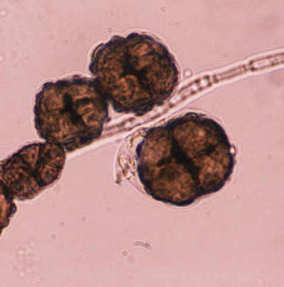 병원균(분생포자)