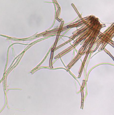 병원균(분생포자 및 분생포자경)