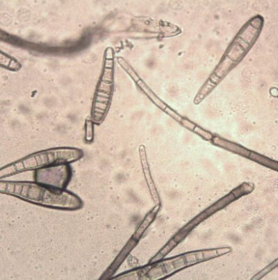 병원균(분생포자)