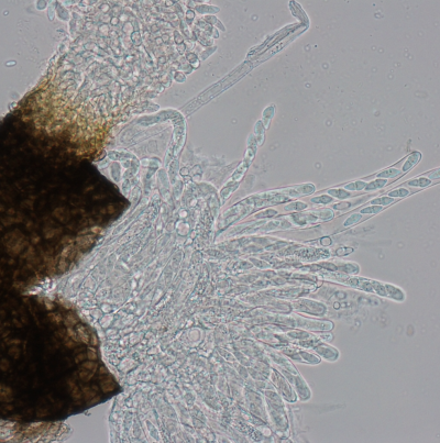 병원균(자낭각 및 자낭과 자낭포자)