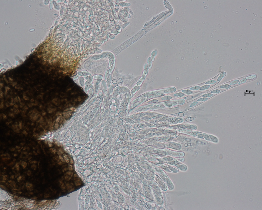 병원균(자낭각 및 자낭과 자낭포자)