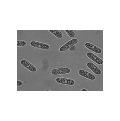 병원균(분생포자)