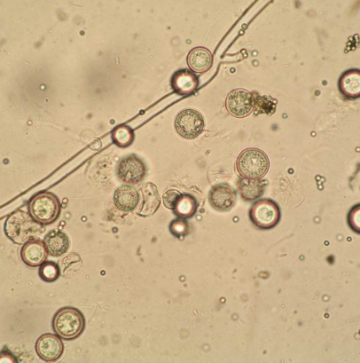 병원균(P. ultimum 난포자)