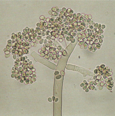 병원균(분생자경)