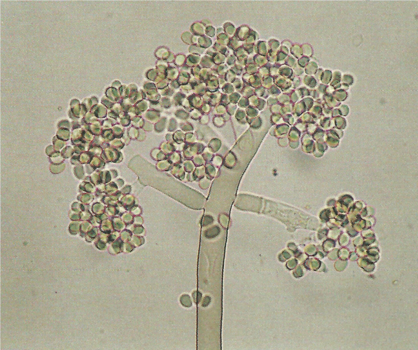 병원균(분생자경)
