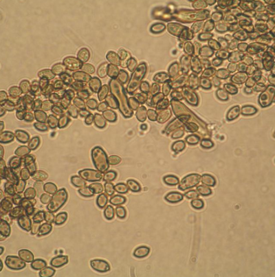 병원균(분생포자)