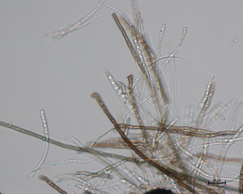 병원균(분생포자)