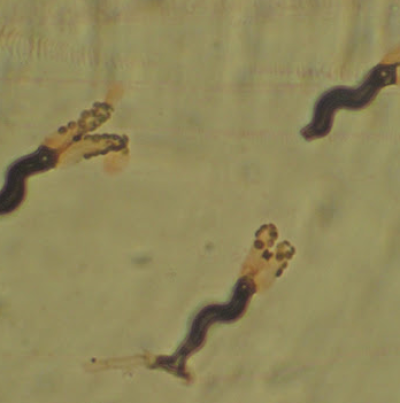 병원균(분생포자)