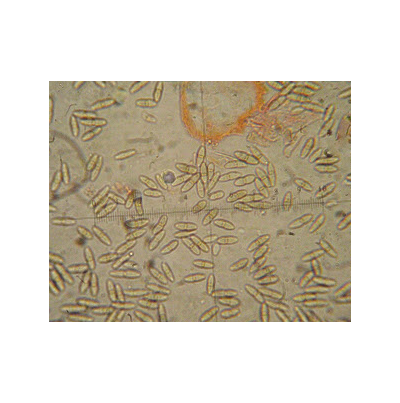 병원균(병포자)