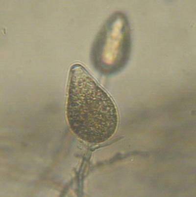 병원균(유주자낭)