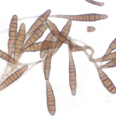 병원균(분생포자)