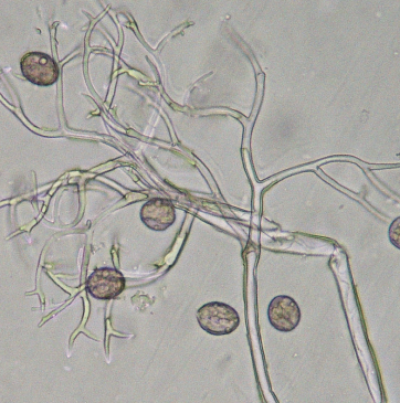 병원균(분생포자)