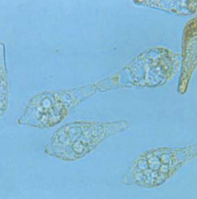 병원균(분생포자)