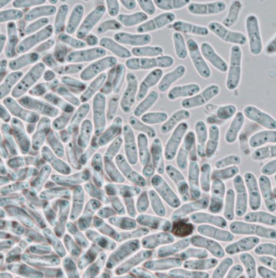 병원균(병포자)