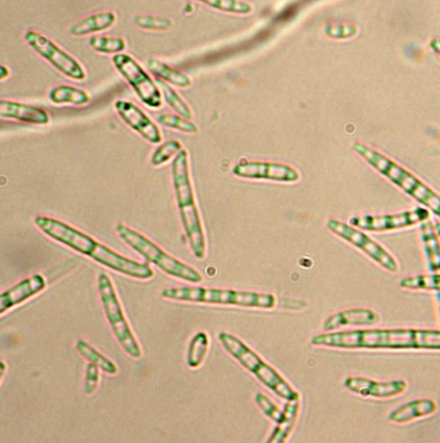 병원균(분생포자)