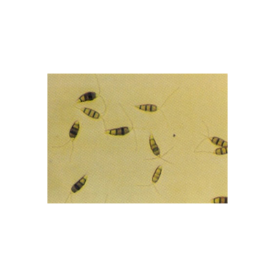 병원균(분생포자)