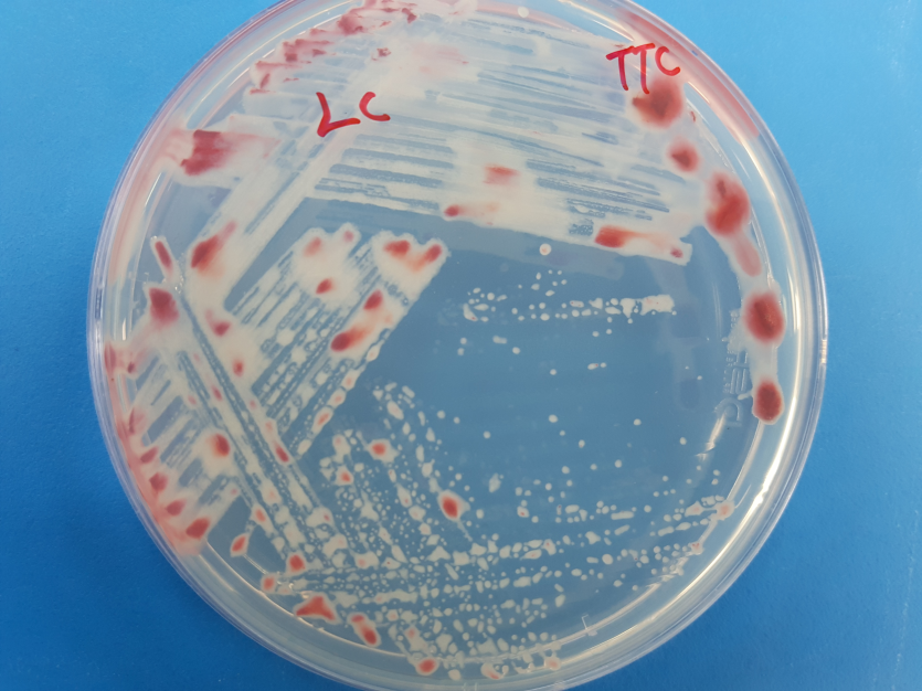 배지(TTC)에 형성된 병원세균