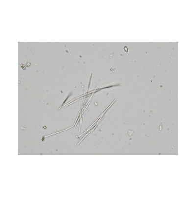 병원균(분생포자)