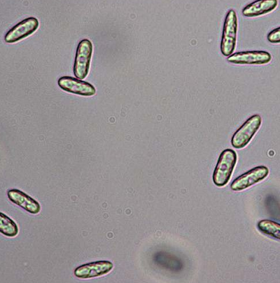 병원균(C. acutatum)분생포자
