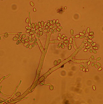 병원균(분생포자)