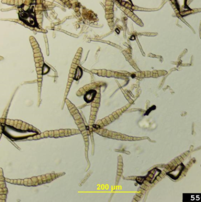 병원균(A.brassicae)