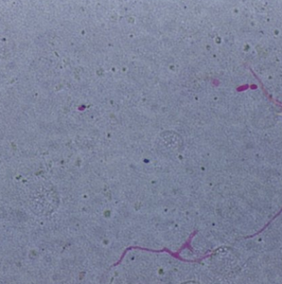 병원균(분생포자, Methyl Red 포자 염색)