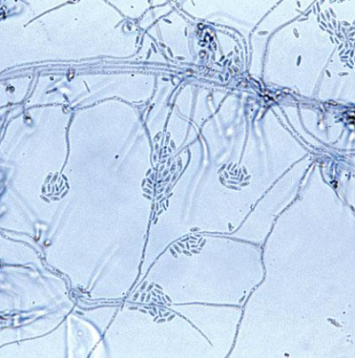 병원균(Acremonnium)