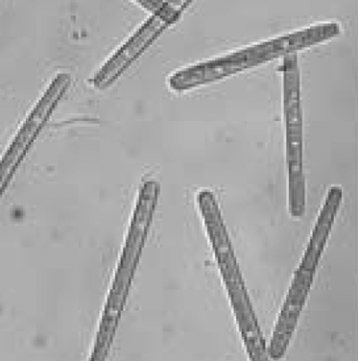 병원균(분생포자)