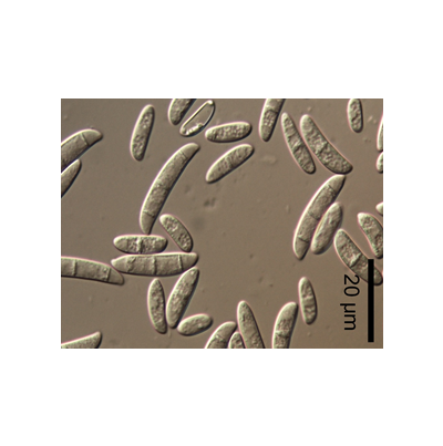 병원균(분생포자)