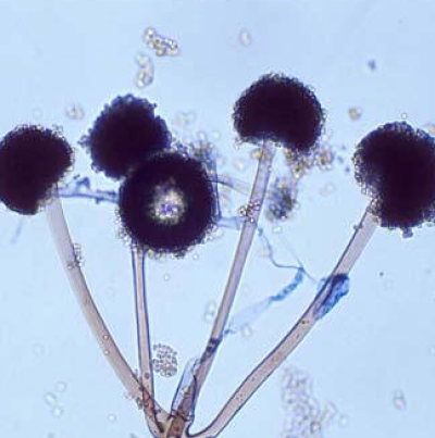 병원균의 포자낭
