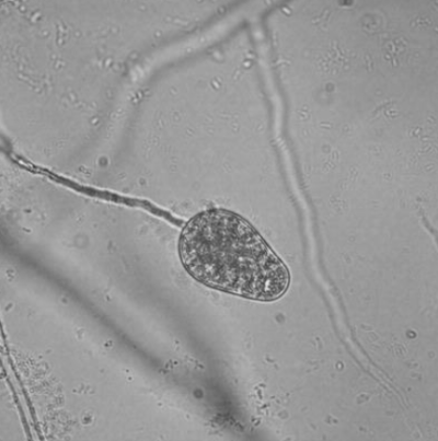 병원균(유주자낭)