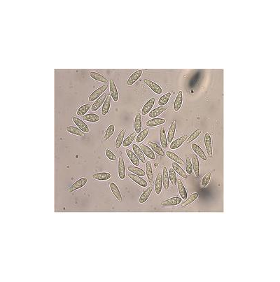 병원균(병포자)    