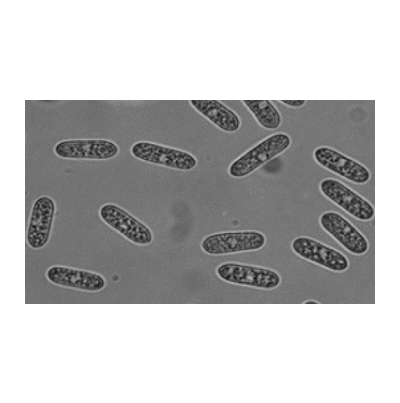 병원균(분생포자)