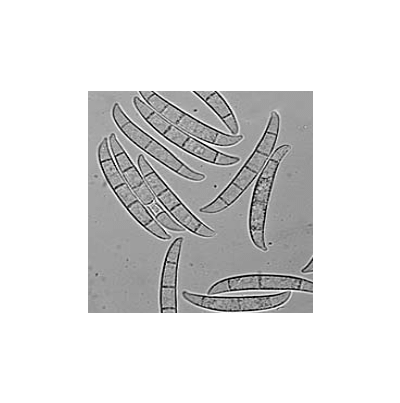 병원균(대형분생포자)