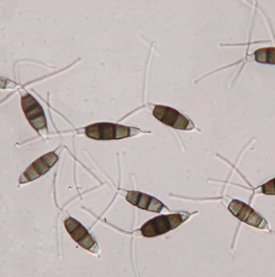 병원균(분생포자)