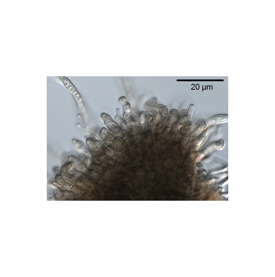 병원균(분생포자)