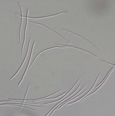 병원균(병포자)