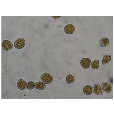 병원균(하포자)
