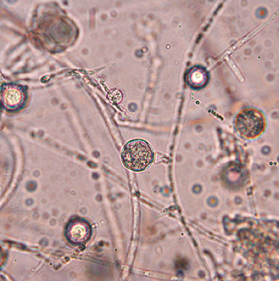 병원균 (난포자)