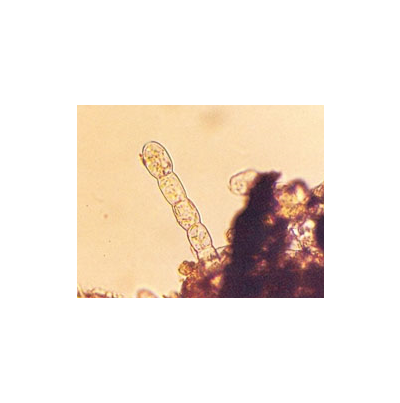 병원균(분생생포자)