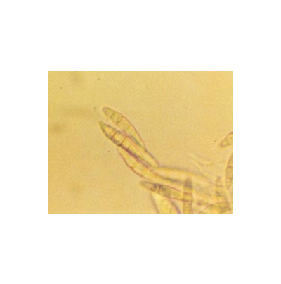 병원균(자낭포자)