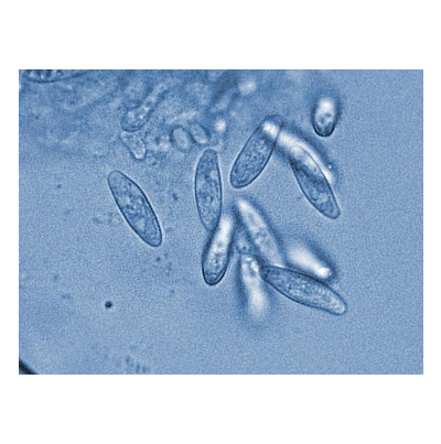 병원균(병포자)
