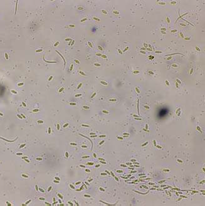 병원균(α포자와 β포자)  